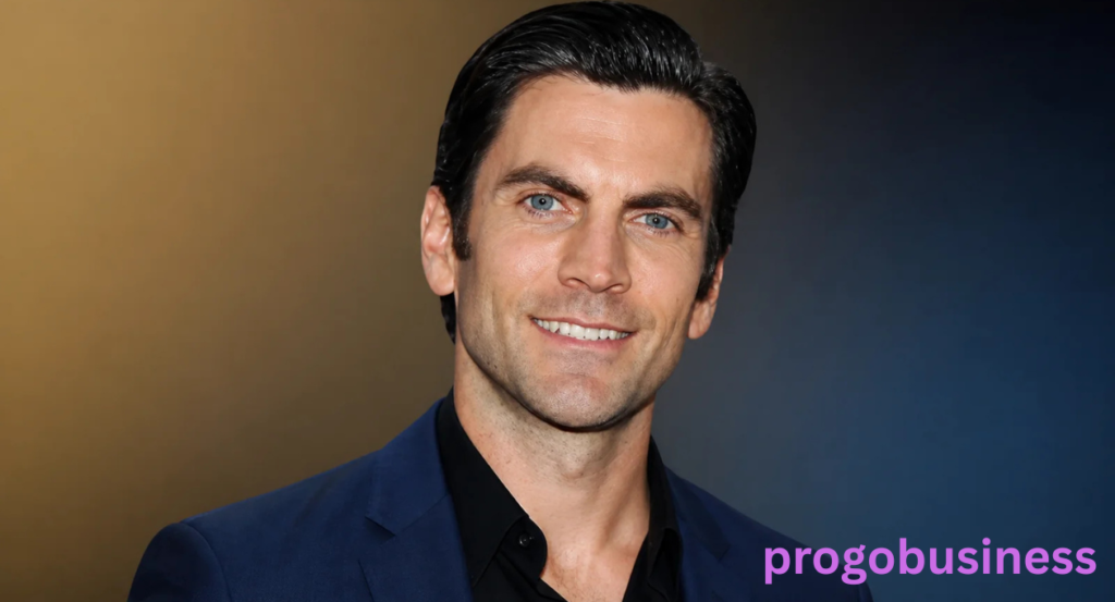 Wes Bentley Teeth