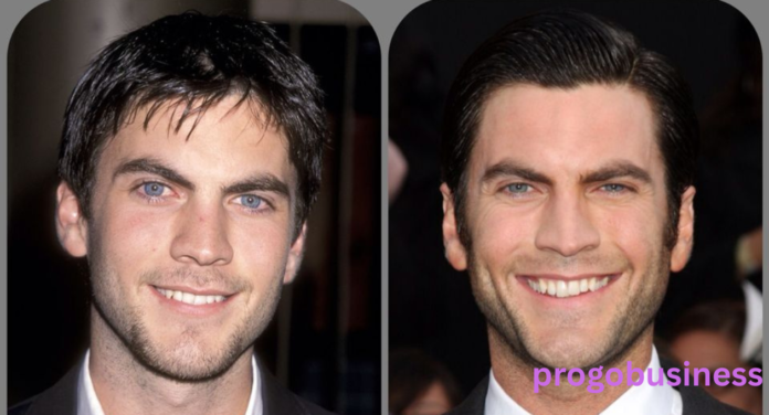 Wes Bentley Teeth